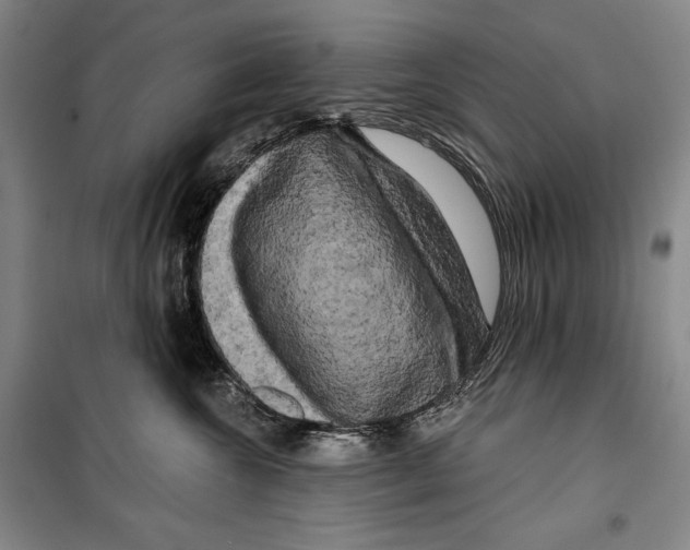 X0000099450572200806061109