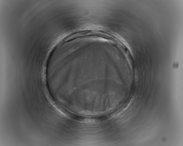 X0000099450581200806061108