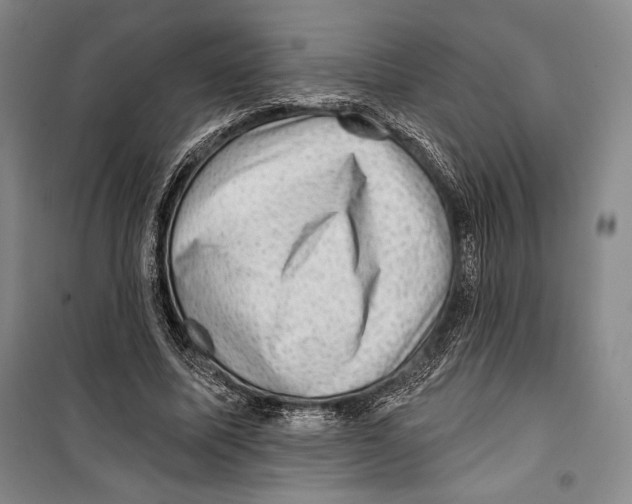 X0000099450587200806061108