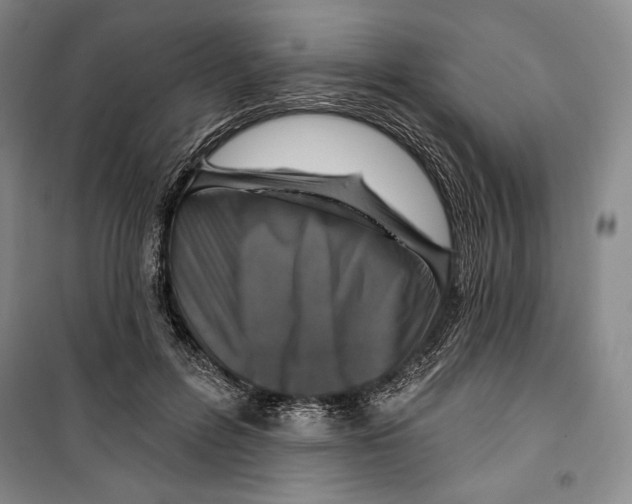 X0000099450600200806061108