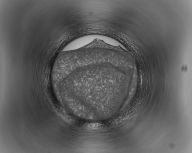 X0000099450695200806061106