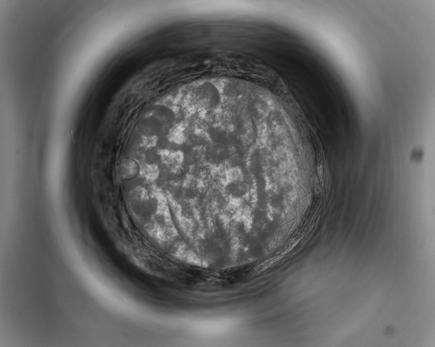 X0000099450765200806061106