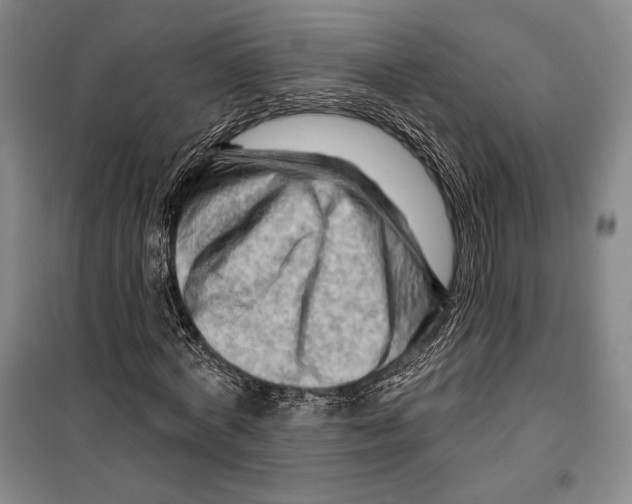 X0000099450772200806061105