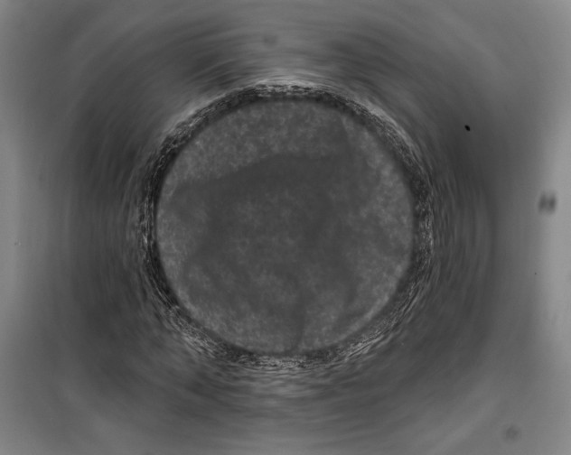 X0000099450870200806061103