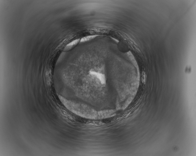 X0000099450915200806061102