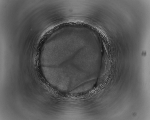 X0000099450920200806061102