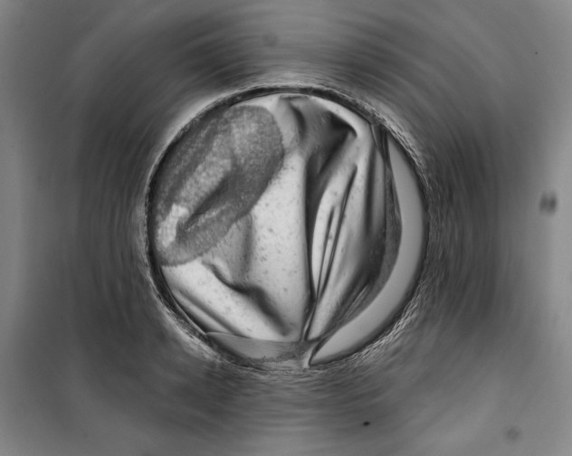 X0000099450942200806061102