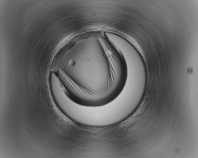 X0000099450946200806061102