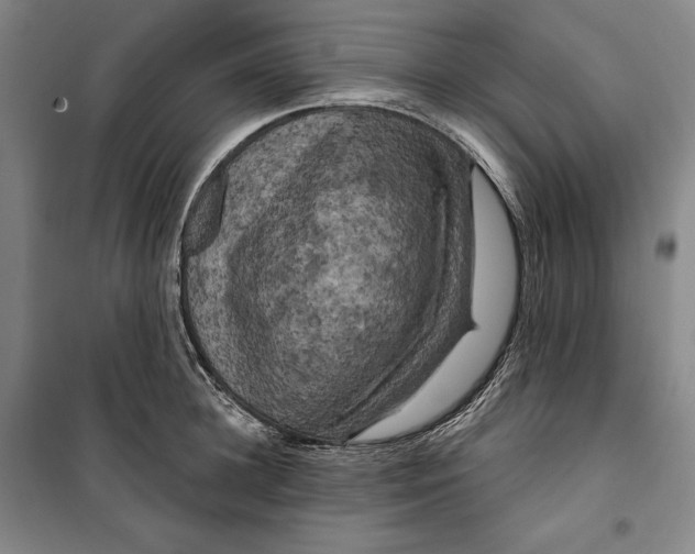 X0000099450948200806061102