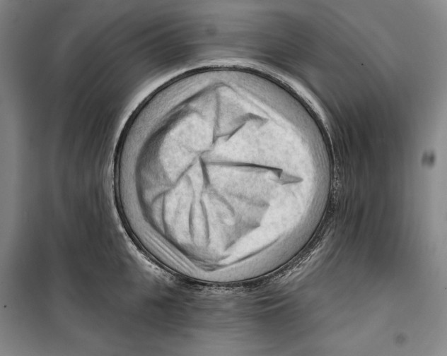 X0000099450951200806061102