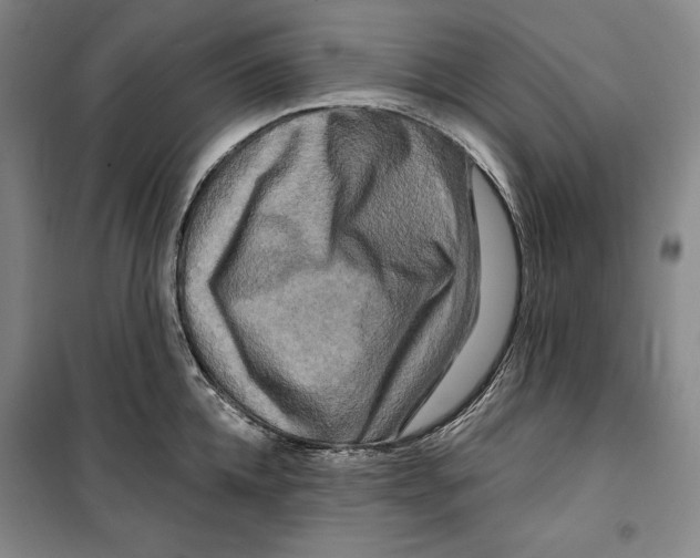 X0000099450952200806061102