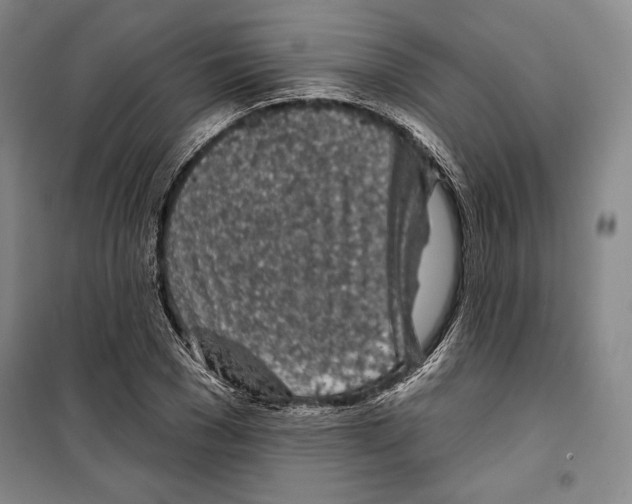 X0000099450977200806061102