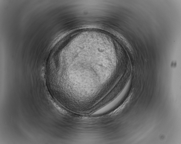 X0000099450985200806061101