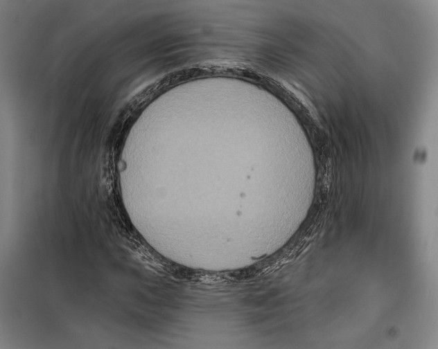 X0000099451015200806061101