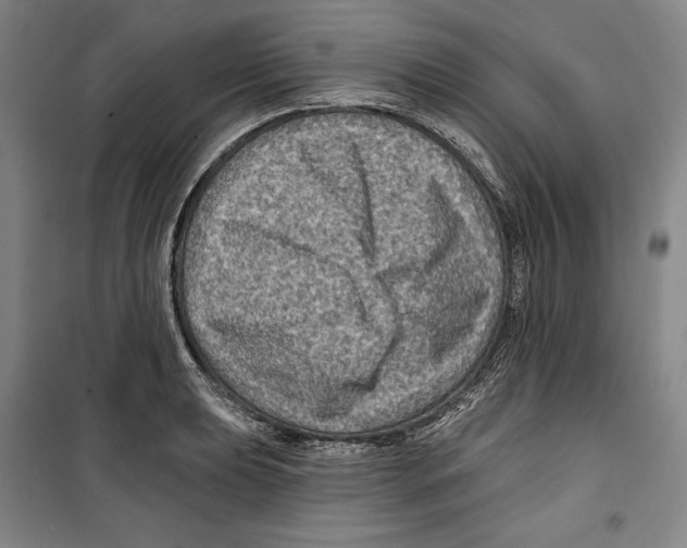 X0000099451039200806061101