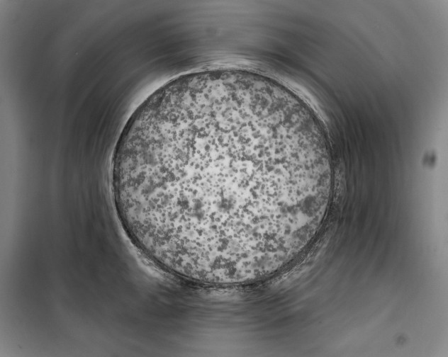 X0000099451047200806061101