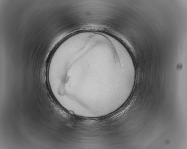 X0000099451075200806061100