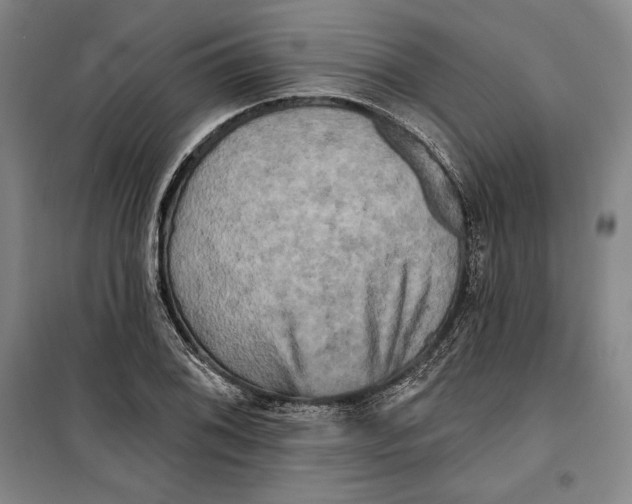 X0000099451076200806061100