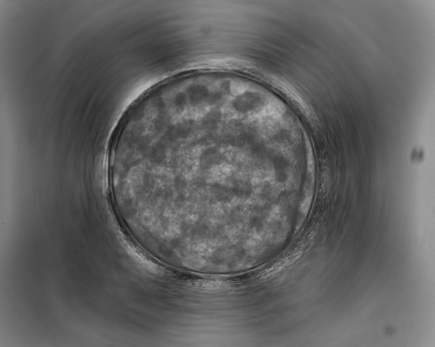 X0000099451079200806061100