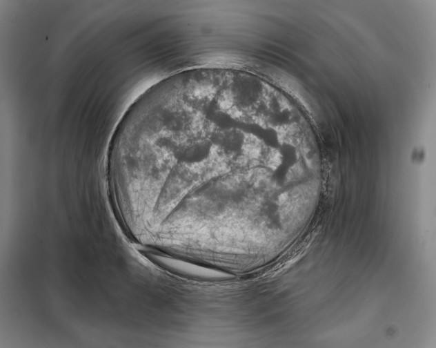 X0000099451087200806061100