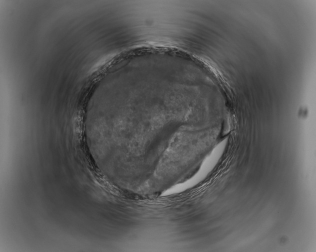 X0000099451110200806061059