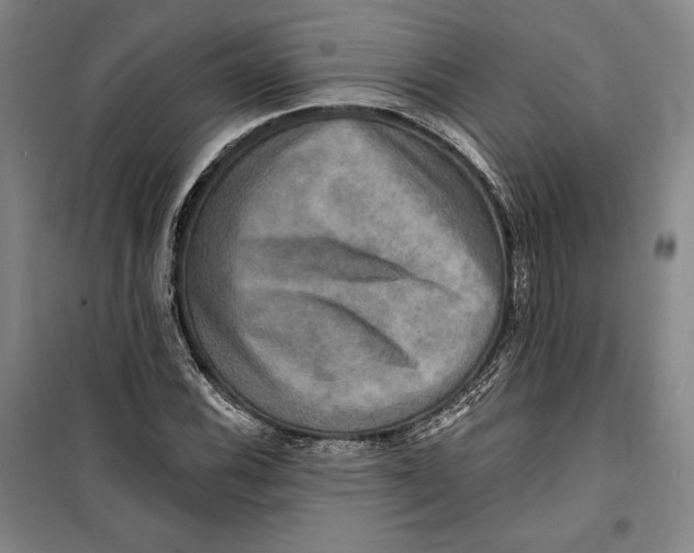 X0000099451116200806061059