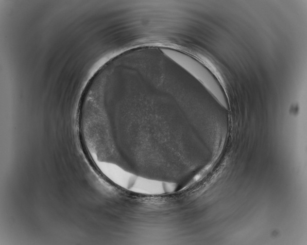 X0000099451141200806061100