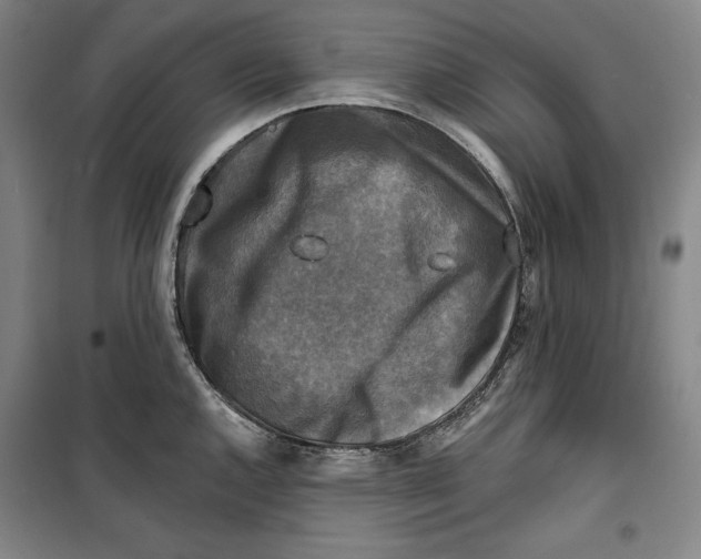 X0000099451144200806061100