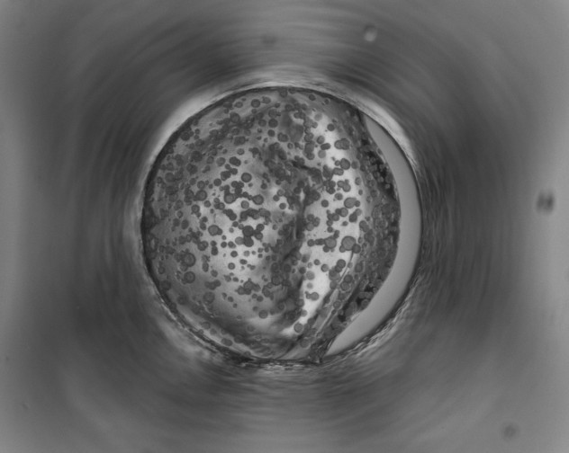 X0000099451146200806061100