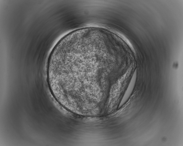 X0000099451148200806061100