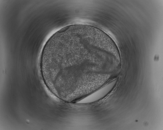 X0000099451152200806061100