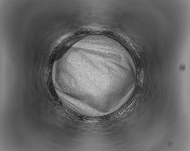 X0000099451157200806061059