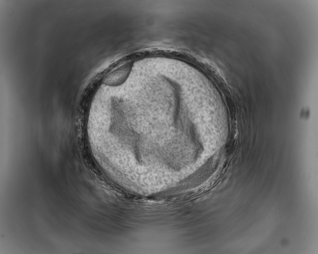 X0000099451159200806061059