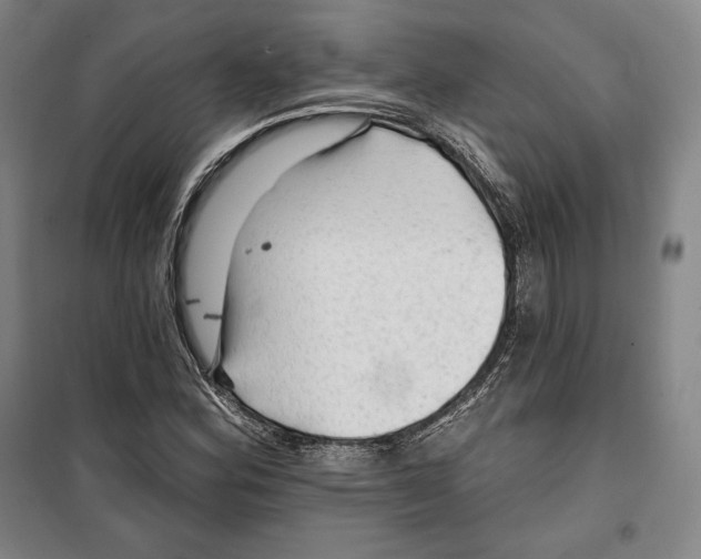 X0000099451164200806061059