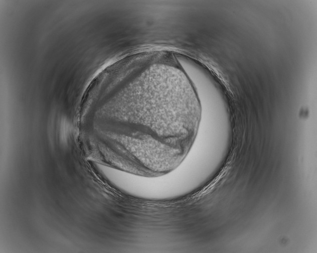 X0000099451165200806061059