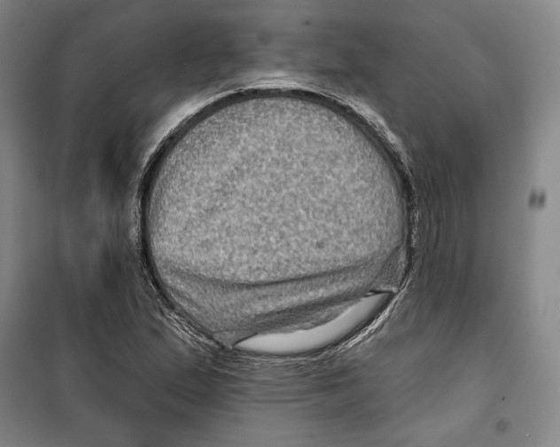 X0000099451167200806061059