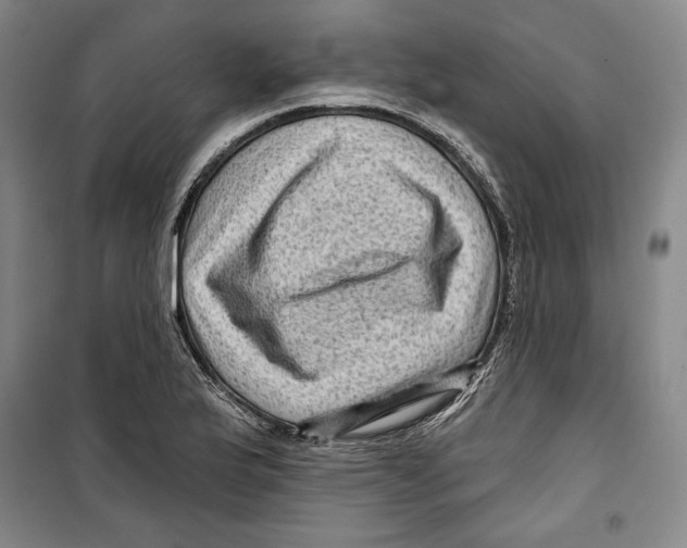 X0000099451175200806061059