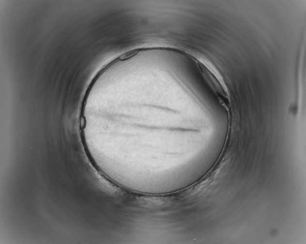 X0000099451197200806061058