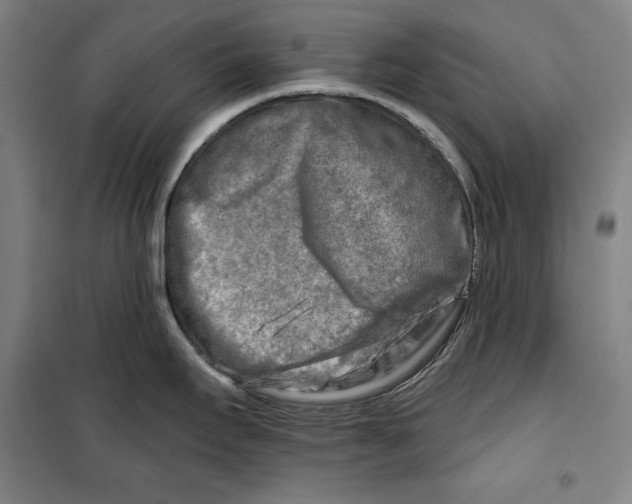 X0000099451295200806061057