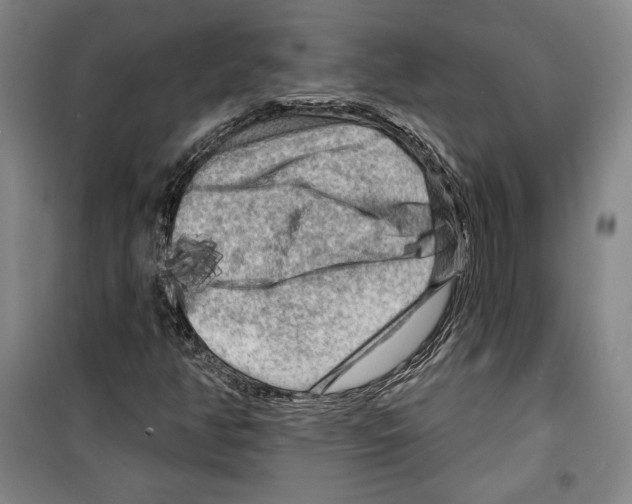 X0000099451350200806061056