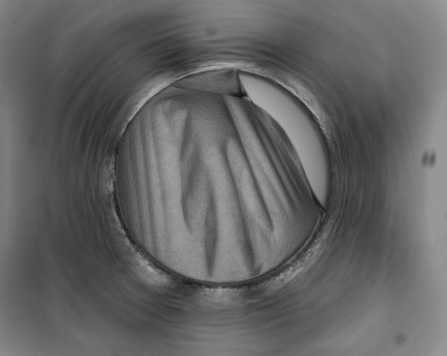 X0000099451377200806061056