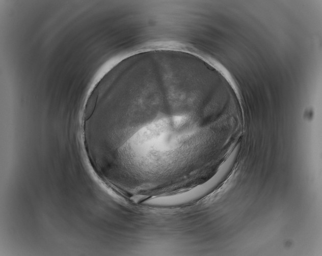 X0000099451389200806061056