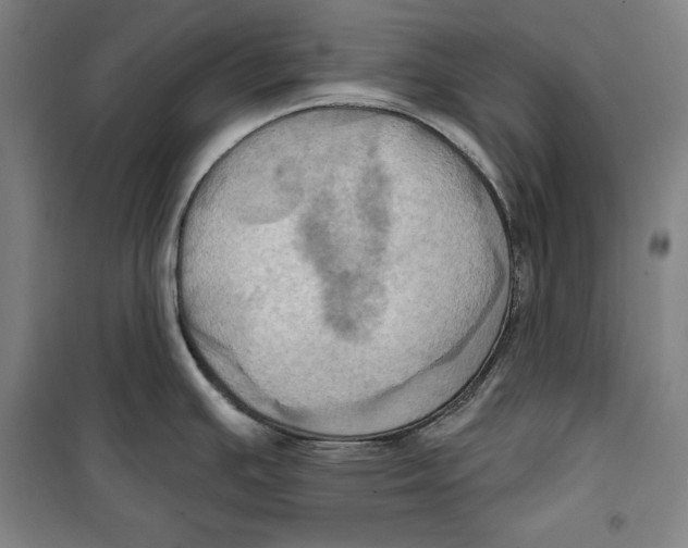 X0000099451391200806061056