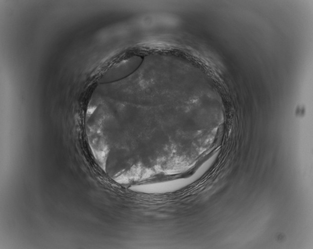 X0000099451397200806061055