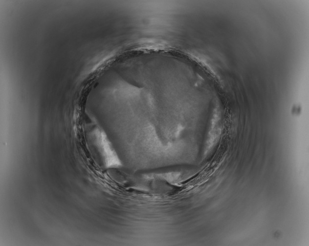 X0000099451399200806061055