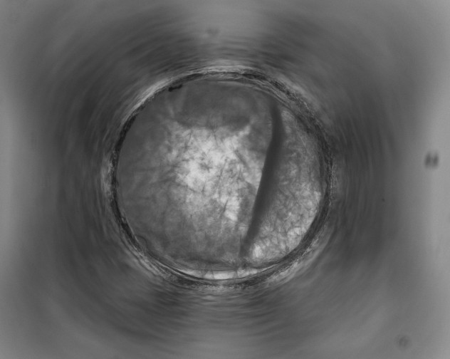 X0000099451401200806061055