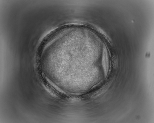 X0000099451448200806061055