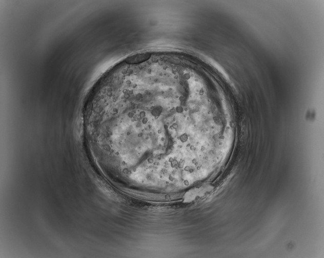 X0000099451461200806061055