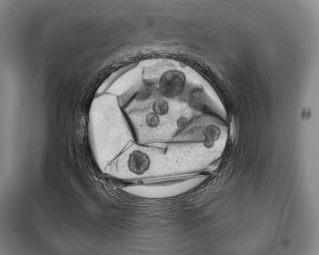 X0000099451492200806061054