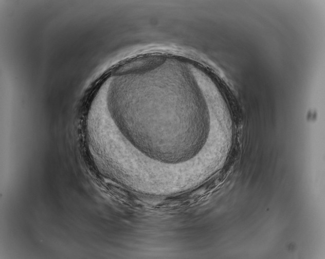 X0000099451496200806061054